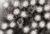 norovirus cells